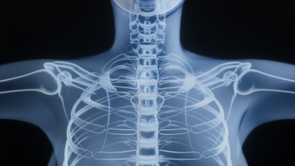 X-ray of a human torso and shoulders